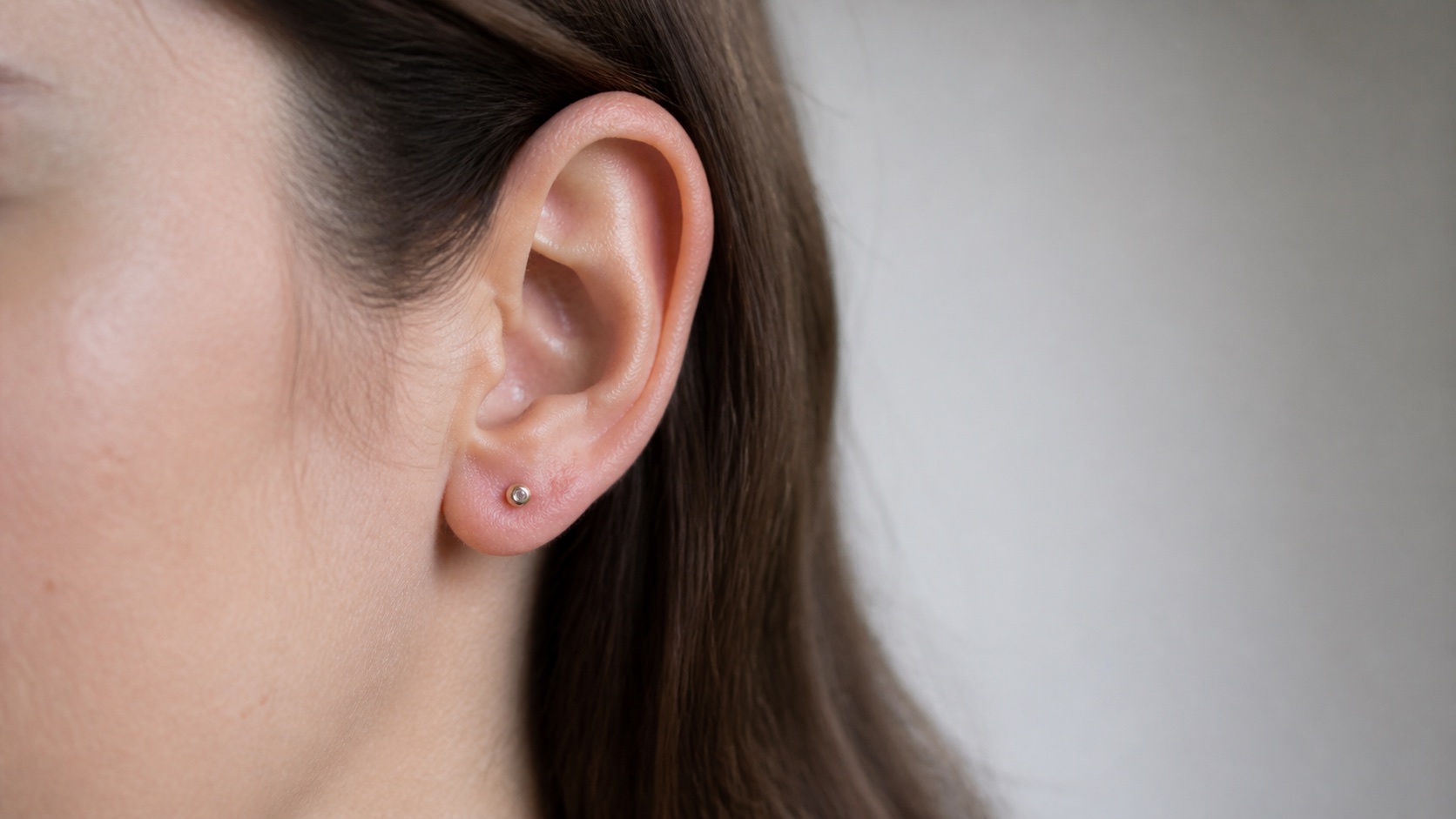 Mild earlobe irritation from a possible nickel allergy to earrings